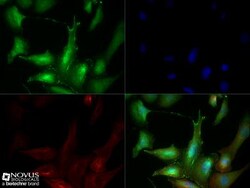 anti-Synaptophysin, Polyclonal, Novus Biologicals 0.025mL; Unlabeled, Quantity: