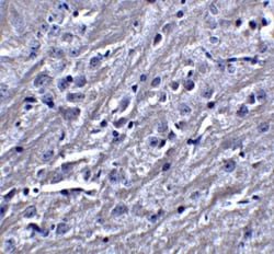 Synaptopodin Antibody - BSA Free, Novus Biologicals 0.1mg; Unlabeled:Antibodies,