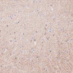 Synaptopodin Antibody, Novus Biologicals:Antibodies:Primary Antibodies