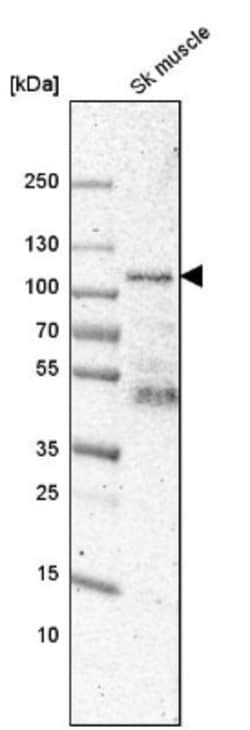Synaptopodin Antibody, Novus Biologicals:Antibodies:Primary Antibodies