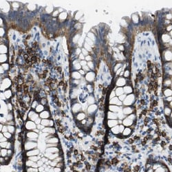 Syndecan-1/CD138 Antibody, Novus Biologicals 0.1mL; Unlabeled:Antibodies,