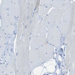 Syndecan-1/CD138 Antibody, Novus Biologicals 0.1mL; Unlabeled:Antibodies,