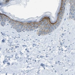 Syndecan-1/CD138 Antibody, Novus Biologicals 0.1mL; Unlabeled:Antibodies,