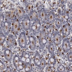 DPEP1 Antibody, Novus Biologicals:Antibodies:Primary Antibodies