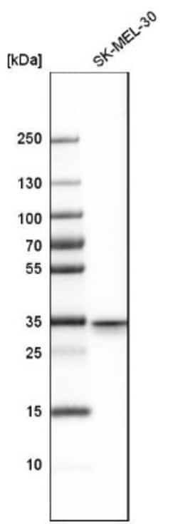 DPEP1 Antibody, Novus Biologicals:Antibodies:Primary Antibodies