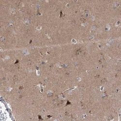 Syntaxin 6 Antibody, Novus Biologicals:Antibodies:Primary Antibodies