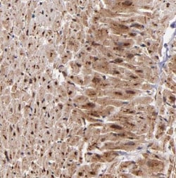 Syntaxin 8 Antibody, Novus Biologicals 25 &mu;L; Unlabeled:Antibodies,