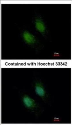 Syntaxin-BP2 Antibody, Novus Biologicals 0.1mL; Unlabeled:Antibodies, Polyclonal