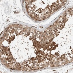 Syntaxin Binding Protein 4 Antibody, Novus Biologicals 25 &mu;L, Unlabeled:Antibodies,