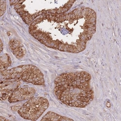 T Plastin Antibody, Novus Biologicals:Antibodies:Primary Antibodies