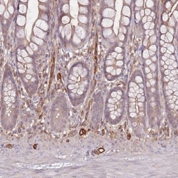 T Plastin Antibody, Novus Biologicals:Antibodies:Primary Antibodies