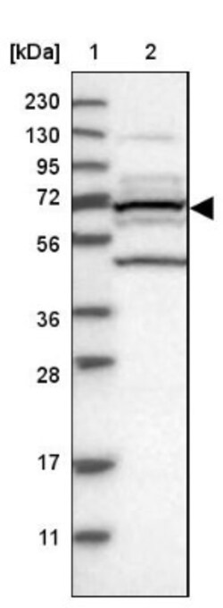T Plastin Antibody, Novus Biologicals:Antibodies:Primary Antibodies