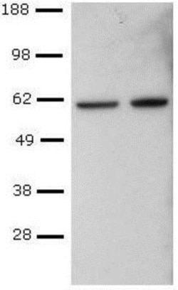 T-bet/TBX21 Antibody (4B10) - BSA Free, Novus Biologicals 0.1mg; Unlabeled:Antistoffer