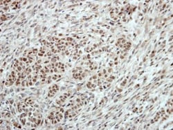 T-bet/TBX21 Antibody, Novus Biologicals 0.1mL; Unlabeled:Antibodies, Polyclonal