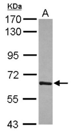 T-bet/TBX21 Antibody, Novus Biologicals 0.1mL; Unlabeled:Antibodies, Polyclonal