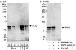 TAB2 Antibody, Novus Biologicals 0.1mg; Unlabeled:Antibodies, Polyclonal