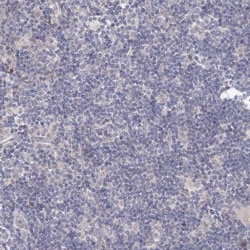 TACC2 Antibody, Novus Biologicals 0.1mL; Unlabeled:Antibodies, Polyclonal