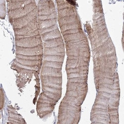 TACC2 Antibody, Novus Biologicals 0.1mL; Unlabeled:Antibodies, Polyclonal