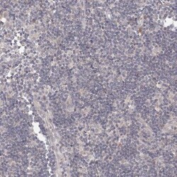 TACC2 Antibody, Novus Biologicals 0.1mL; Unlabeled:Antibodies, Polyclonal