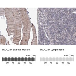 TACC2 Antibody, Novus Biologicals 0.1mL; Unlabeled:Antibodies, Polyclonal