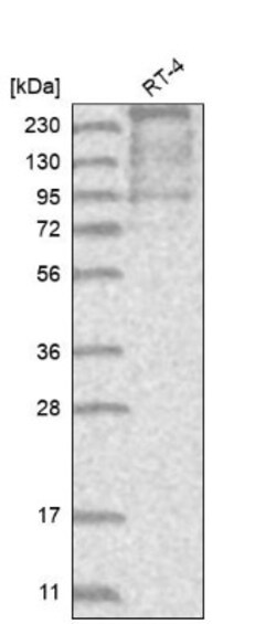 TACC2 Antibody, Novus Biologicals 0.1mL; Unlabeled:Antibodies, Polyclonal