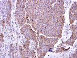 TACE/ADAM17 Antibody, Novus Biologicals 0.1mL; Unlabeled:Antibodies, Polyclonal
