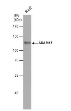 TACE/ADAM17 Antibody, Novus Biologicals 0.1mL; Unlabeled:Antibodies, Polyclonal