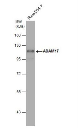 TACE/ADAM17 Antibody, Novus Biologicals 0.1mL; Unlabeled:Antibodies, Polyclonal