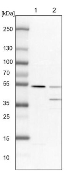 TADA3L Antibody, Novus Biologicals 25 &mu;L; Unlabeled:Antibodies, Polyclonal