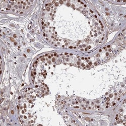 TAF13 Antibody, Novus Biologicals:Antibodies:Primary Antibodies