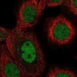 TAF148 Antibody, Novus Biologicals:Antibodies:Primary Antibodies