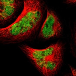TAF5 Antibody, Novus Biologicals 0.1mL; Unlabeled:Antibodies, Polyclonal