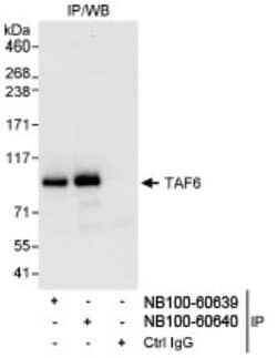 TAF6 Antibody, Novus Biologicals 0.1mg; Unlabeled:Antibodies, Polyclonal