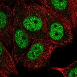 TAF6L Antibody, Novus Biologicals:Antibodies:Primary Antibodies