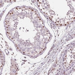 TAF6L Antibody, Novus Biologicals:Antibodies:Primary Antibodies