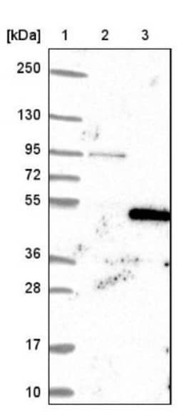 TAF8 Antibody, Novus Biologicals 0.1mL; Unlabeled:Antibodies, Polyclonal