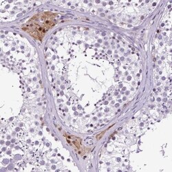 TAFA3/FAM19A3 Antibody, Novus Biologicals:Antibodies:Primary Antibodies