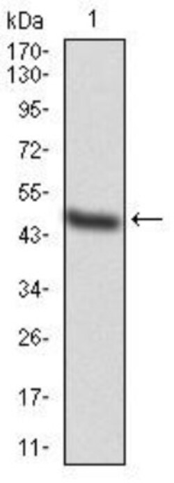 TAK1 Antibody (3E8H4), Novus Biologicals 0.025 mg; Unlabeled:Antibodies,