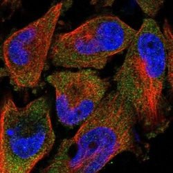 TAL2 Antibody, Novus Biologicals 0.1mL; Unlabeled:Antibodies, Polyclonal