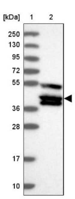 TANK Antibody, Novus Biologicals 0.1mL; Unlabeled:Antibodies, Polyclonal
