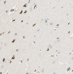 TAO2 Antibody, Novus Biologicals 0.1mL; Unlabeled:Antibodies