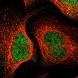 ZP2 Antibody, Novus Biologicals:Antibodies:Primary Antibodies