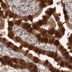 ZP2 Antibody, Novus Biologicals:Antibodies:Primary Antibodies