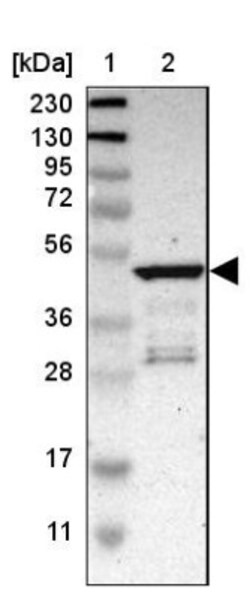 ZP2 Antibody, Novus Biologicals:Antibodies:Primary Antibodies