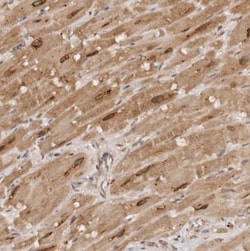 TARS2 Antibody, Novus Biologicals:Antibodies:Primary Antibodies