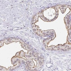 TAS1R3 Antibody, Novus Biologicals 0.1mL; Unlabeled:Antibodies, Polyclonal