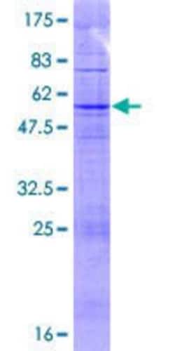 Novus Biologicals Recombinant Human TAS2R43 GST (N-Term) Protein 10 &mu;g | Buy Online | Novus Biologicals&trade; | Fisher Scientific