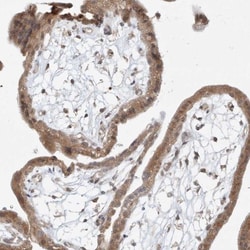 TASP1 Antibody, Novus Biologicals 0.1mL; Unlabeled:Antibodies, Polyclonal