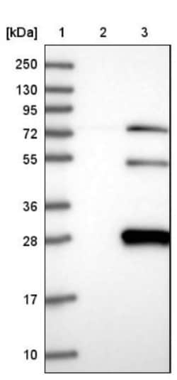 TASP1 Antibody, Novus Biologicals 0.1mL; Unlabeled:Antibodies, Polyclonal