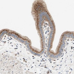 TATA Element Modulatory Factor 1 Antibody, Novus Biologicals:Antibodies:Primary